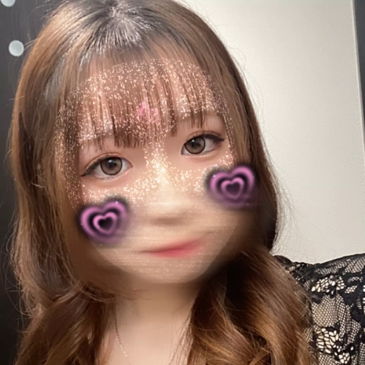 事故って足怪我しちゃった…